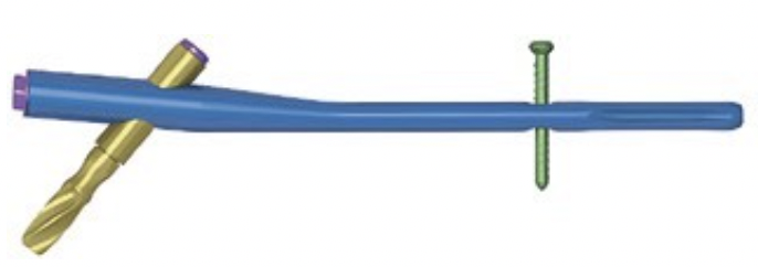 PFNA стегновий стрижень Jinlu